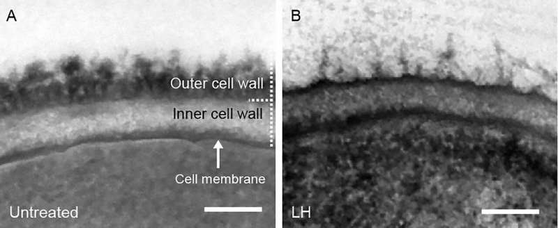 Synthetic polymers against fungal infections