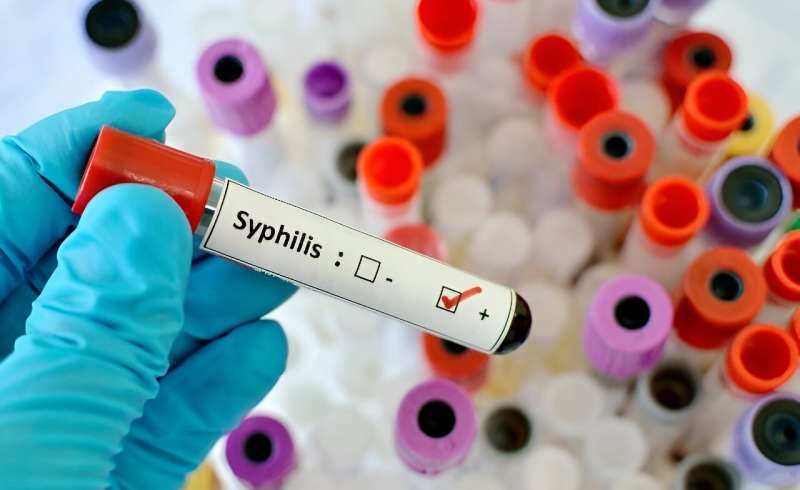 Syphilis is increasingly displaying atypical, severe symptoms