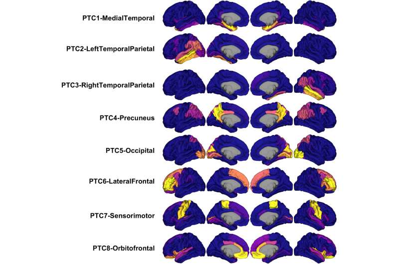Tau protein deposition patterns predict Alzheimer's severity