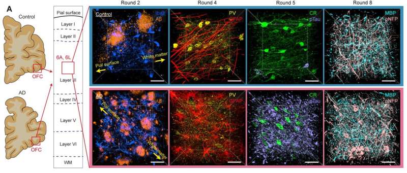 Technologies enable 3D imaging of whole human brain hemispheres at subcellular resolution