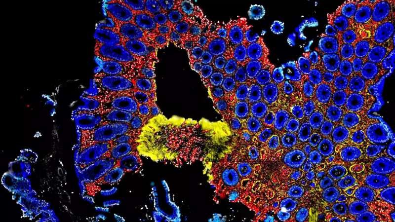 The gut microbiome prevents dangerous immune reactions
