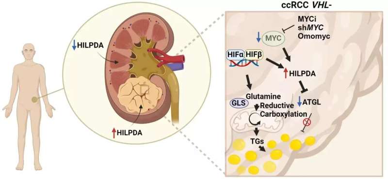 The HILPDAprotein: A potential biomarker for new treatment options in aggressive kidney cancer