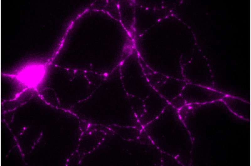 The role of an energy-producing enzyme in treating Parkinson's disease