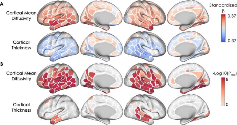 The spatial pattern of pathological changes in the brain can help identify dementia vulnerability early