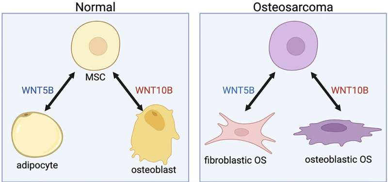 The targeting of WNT5B and WNT10B in osteosarcoma