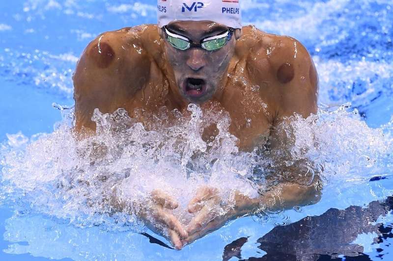 The telltale red marks of cupping seen on the shoulders of swimming great Michael Phelps in Rio