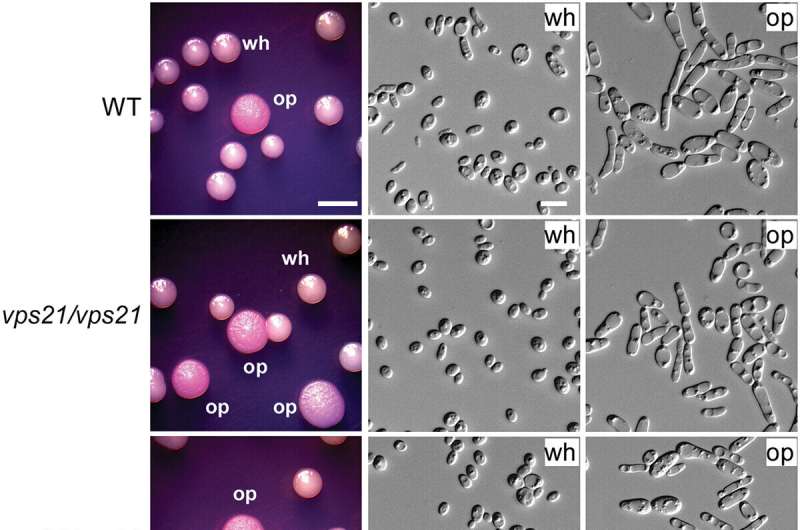 The Vps21 signaling pathway regulates white-opaque switching and mating in Candida albicans