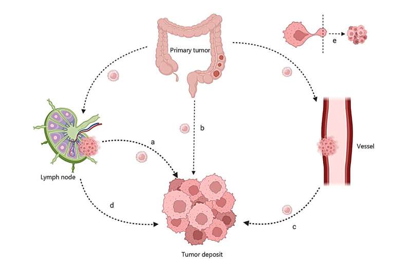 Depósitos tumorais em câncer colorretal e gástrico
