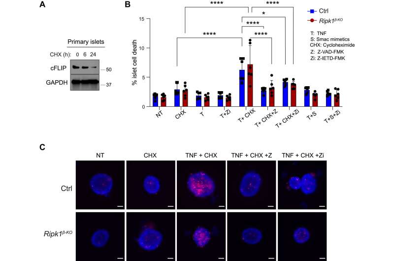 Unique mechanism protects pancreatic cells from inflammation in mice