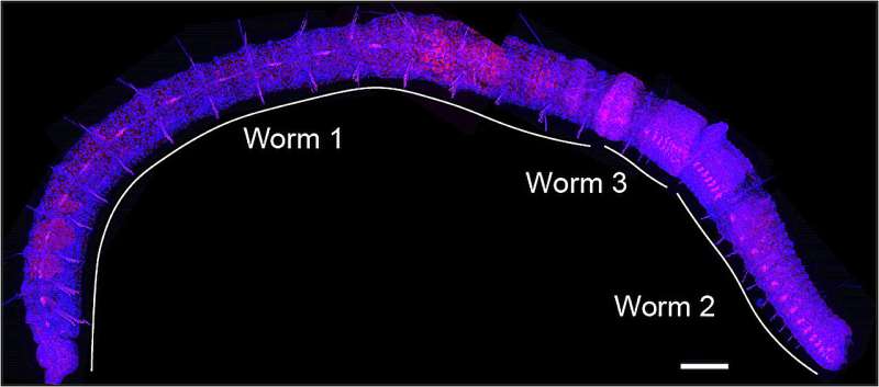 Unlocking the 'chain of worms'