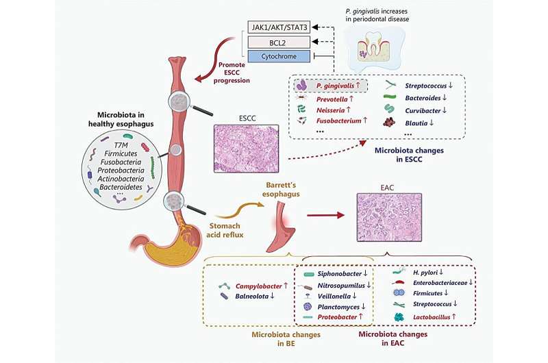 Unraveling the link between microbiome and esophageal cancer: new insights from recent research