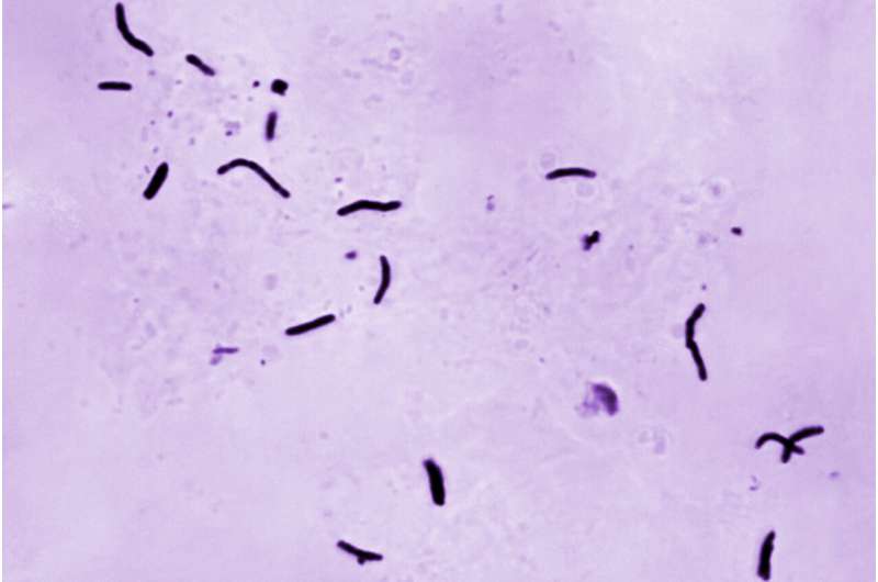 US tuberculosis cases were at their the highest level in a decade in 2023