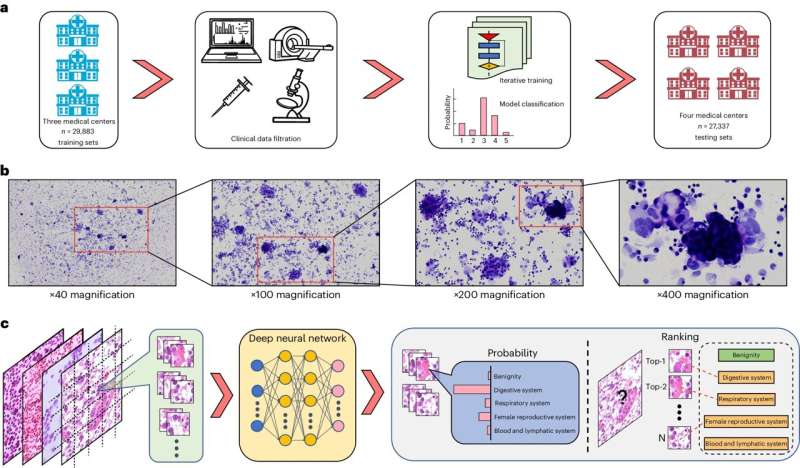 Using AI to trace the origins of metastatic cancer cells