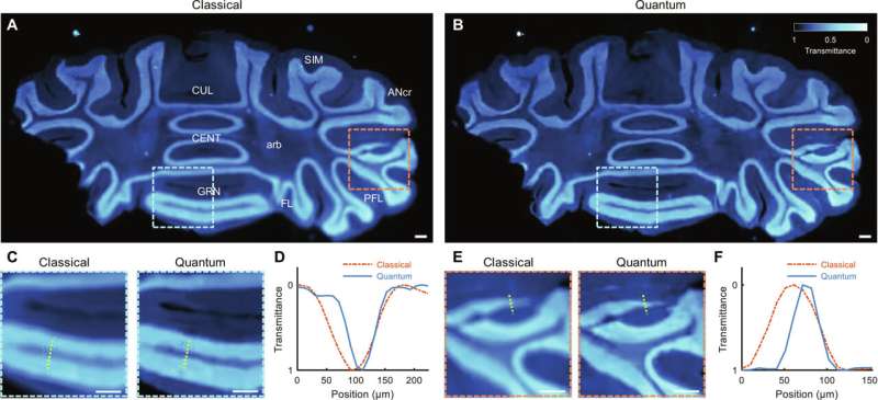 Using polarization to improve quantum imaging