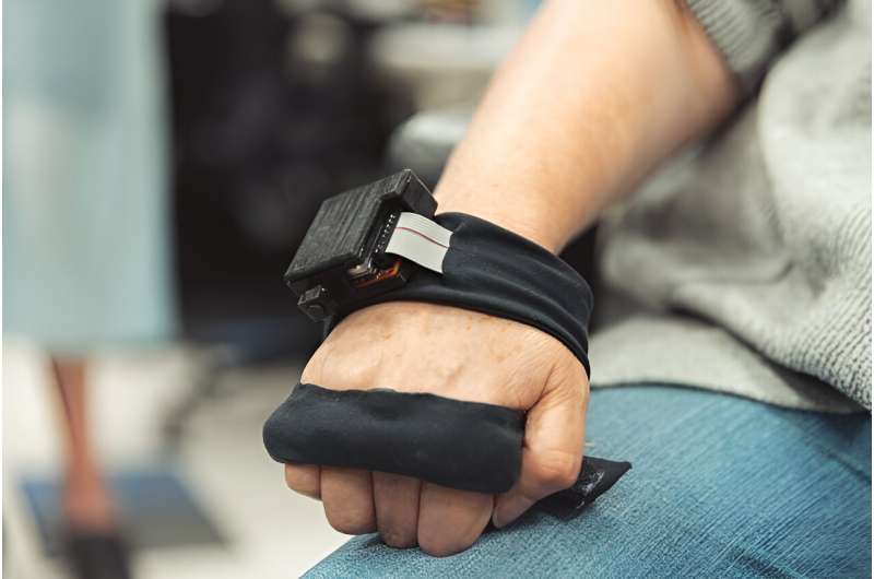 Vibrating glove helps stroke patients recover from muscle spasms