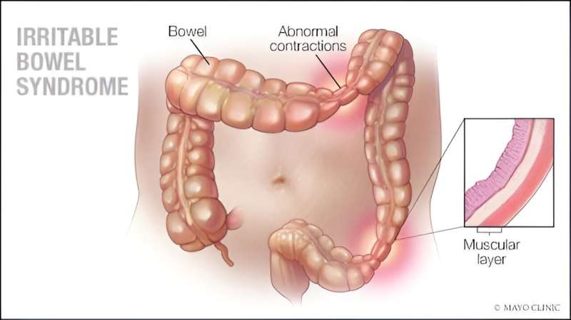 Video: How to cope with irritable bowel syndrome