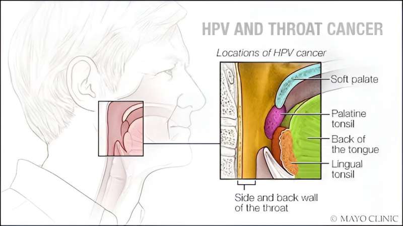 Video: The link between HPV and throat cancer