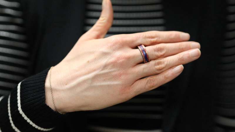 Want a noninvasive health monitor? Put a ring on it.