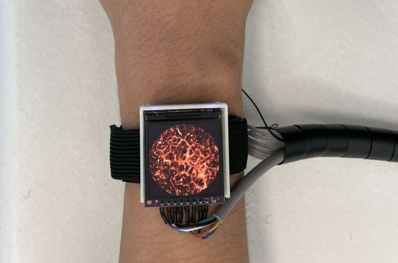 Wearable tech captures real-time hemodynamics on the go
