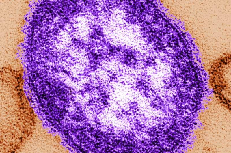Virgínia Ocidental confirma primeiro caso de sarampo desde 2009