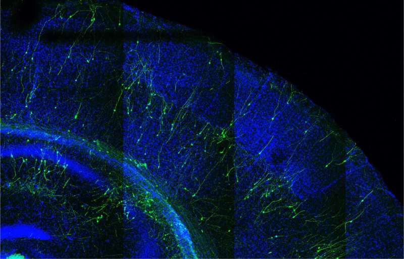 When faster is not better: New study links premature development of human neurons to brain developmental disorders