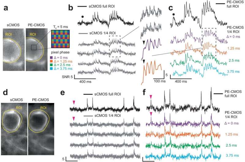 With programmable pixels, novel sensor improves imaging of neural activity