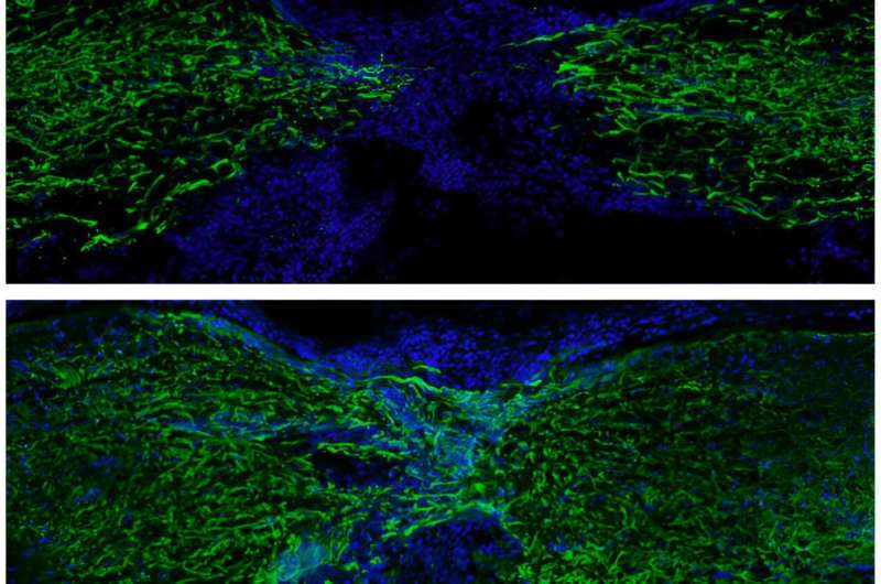 Zebrafish use sudden technique to regrow spinal wire: Findings may lend a hand determine techniques to heal spinal wire harm