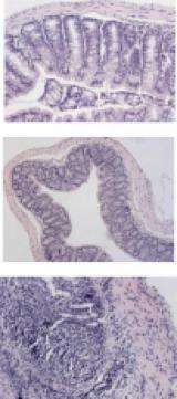 Researchers develop oral delivery system to treat inflammatory bowel diseases