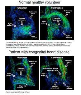 Remarkable new images show a 4-D view of the heart