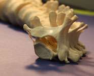 Treating modern back pain with help from old bones