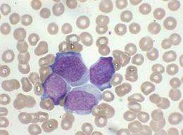 Penn researchers find genetic link to leukemias with an unknown origin