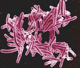 Experimental immune-boosting drug worsens TB in mice