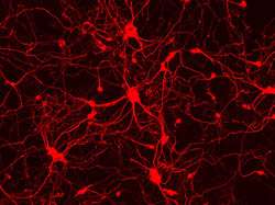 Researchers directly turn mouse skin cells into neurons, skipping IPS stage