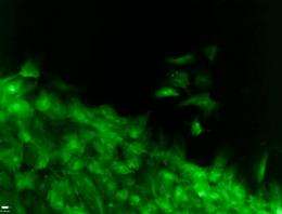 Researchers find sleepy fibroblasts are quite lively