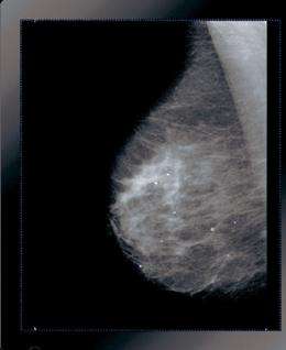 Breast cancer detection improved with image processing