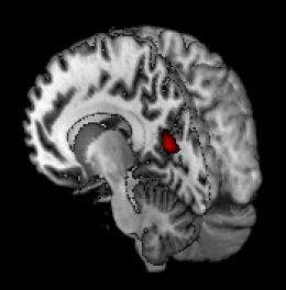 Researchers discover "inner compass" in the human brain