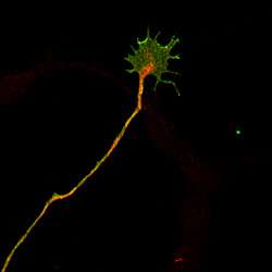 Biologists gain new insights into brain circuit wiring