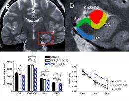 Brain atrophy responsible for depression in people battling multiple sclerosis