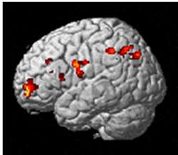 Brain Study: Sensitive Persons' Perception Moderates Responses Based On Culture
