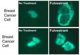 Breast cancer drug fulvestrant appears more effective in the presence of CK8 and CK18