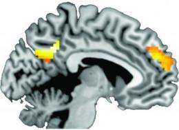 Certain parts of the brain activated in people who heard tailored health messages and quit smoking