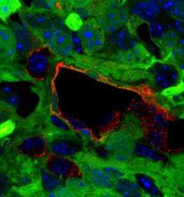 Conversion of brain tumor cells into blood vessels thwarts treatment efforts