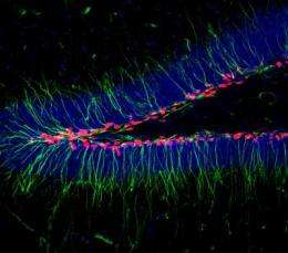 CSHL scientists identify elusive neuronal targets of deep brain stimulation