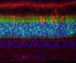Gene therapy sets stage for new treatments for inherited blindness, Penn veterinary researchers say