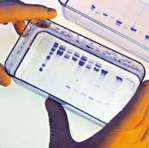 Genetic testing no real help in predicting type 2 diabetes