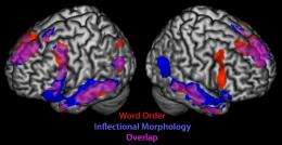Sign language study shows multiple brain regions wired for language