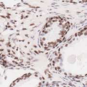Scientists find key protein that suppresses prostate cancer growth in the laboratory