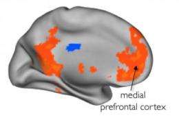 Imaging study shows brain responds more to close friends