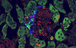 Immune cell plays unexpected role in autoimmune disease