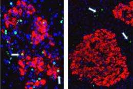 Insulin-creating cell research may lead to better diabetes treatment